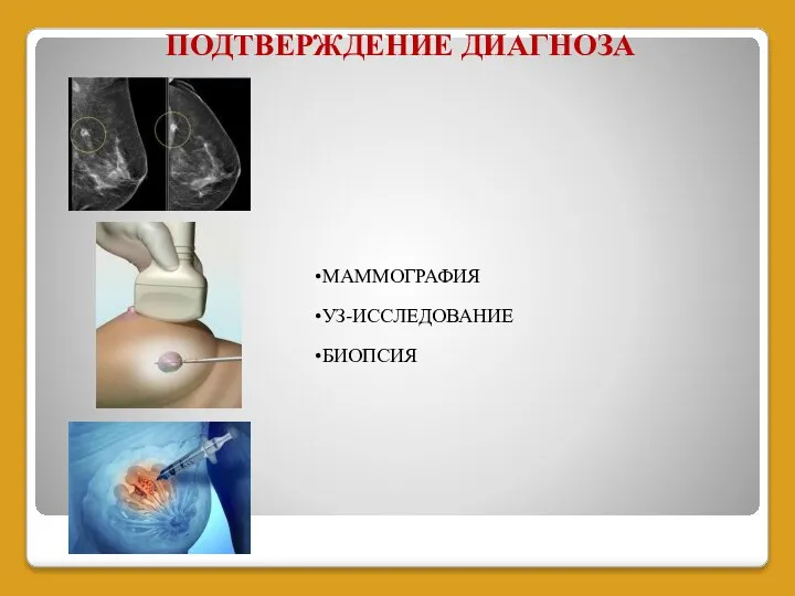 ПОДТВЕРЖДЕНИЕ ДИАГНОЗА МАММОГРАФИЯ УЗ-ИССЛЕДОВАНИЕ БИОПСИЯ