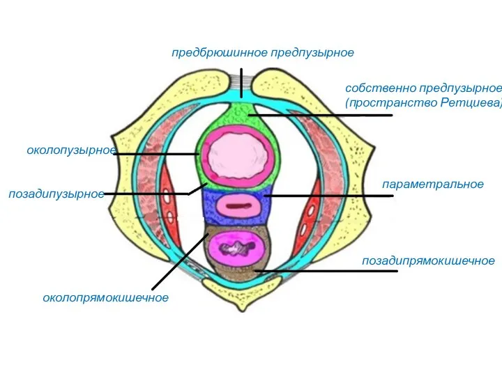 предбрюшинное предпузырное околопузырное позадипрямокишечное параметральное околопрямокишечное собственно предпузырное (пространство Ретциева) позадипузырное