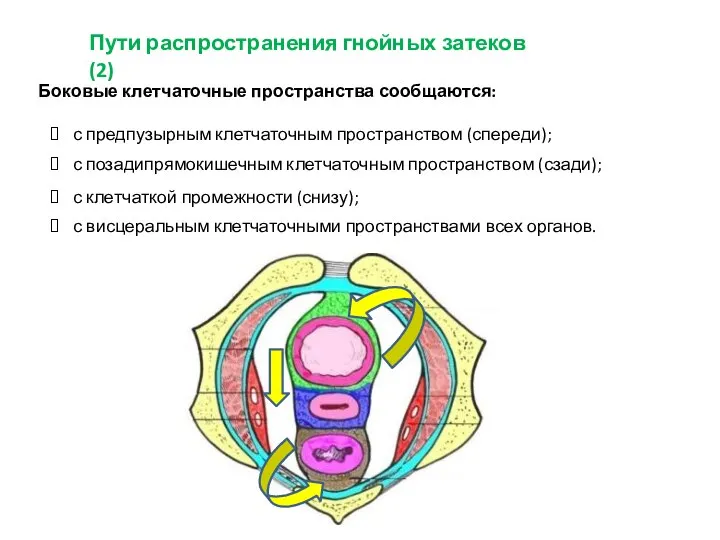 Пути распространения гнойных затеков (2) Боковые клетчаточные пространства сообщаются: с предпузырным клетчаточным