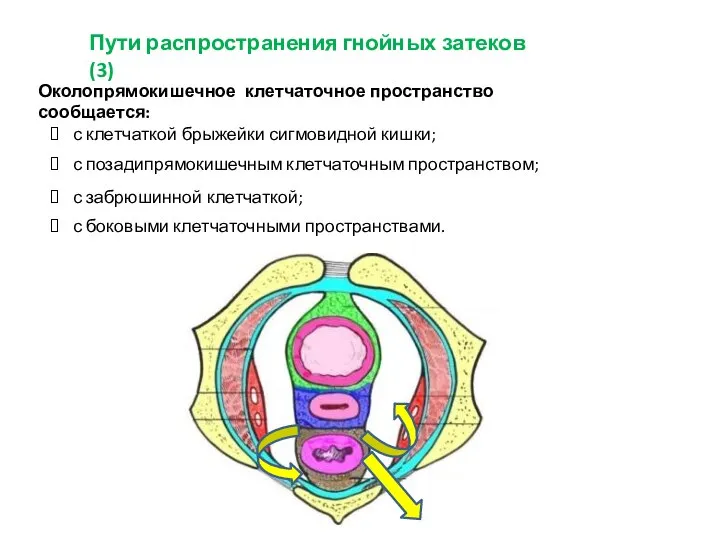 Пути распространения гнойных затеков (3) Околопрямокишечное клетчаточное пространство сообщается: с клетчаткой брыжейки