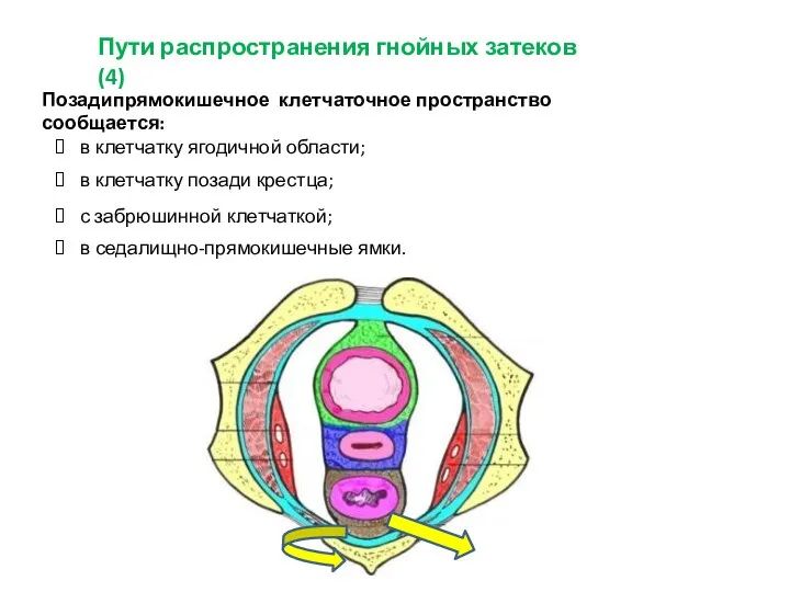 Пути распространения гнойных затеков (4) Позадипрямокишечное клетчаточное пространство сообщается: в клетчатку ягодичной