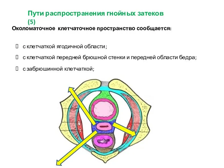 Пути распространения гнойных затеков (5) Околоматочное клетчаточное пространство сообщается: с забрюшинной клетчаткой;