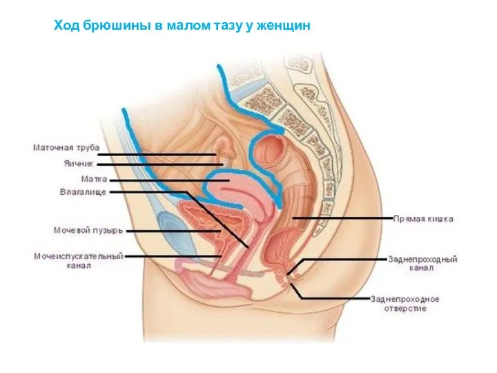 Ход брюшины в малом тазу у женщин