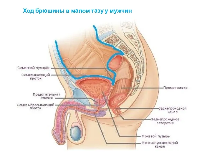 Ход брюшины в малом тазу у мужчин