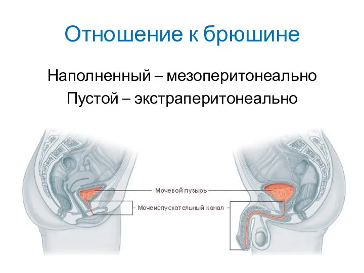 Отношение к брюшине Наполненный – мезоперитонеально Пустой – экстраперитонеально