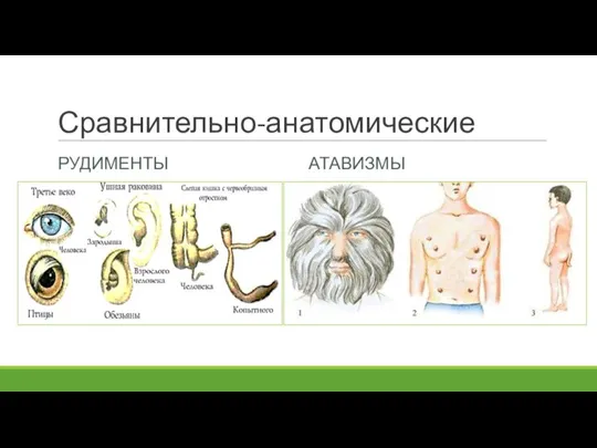 Сравнительно-анатомические РУДИМЕНТЫ АТАВИЗМЫ