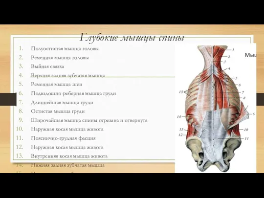 Глубокие мышцы спины Полуостистая мышца головы Ременная мышца головы Выйная связка Верхняя