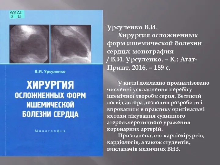 Урсуленко В.И. Хирургия осложненных форм ишемической болезни сердца: монография / В.И. Урсуленко.