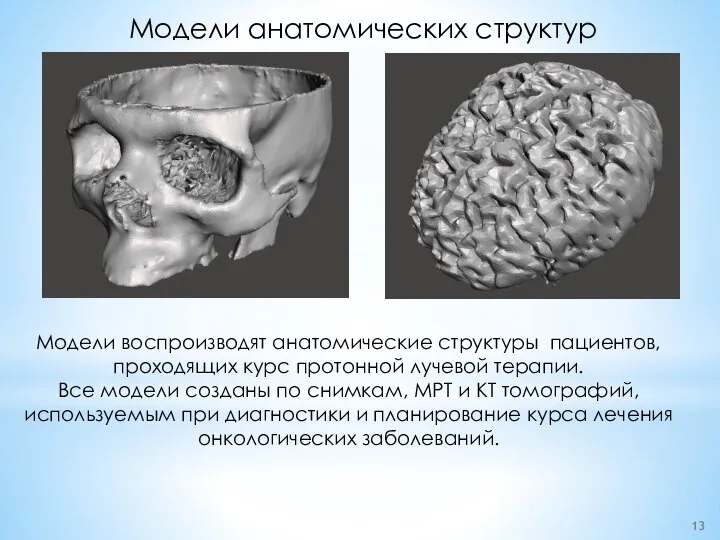 Модели анатомических структур Модели воспроизводят анатомические структуры пациентов, проходящих курс протонной лучевой