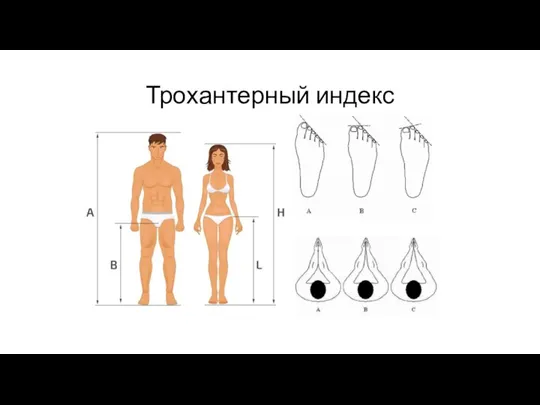 Трохантерный индекс