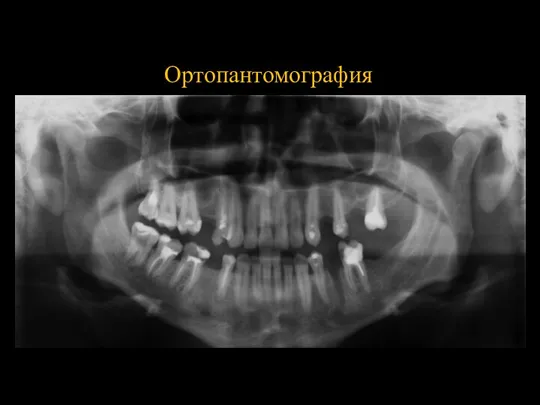 Ортопантомография