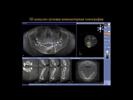 3D конусно-лучевая компьютерная томография