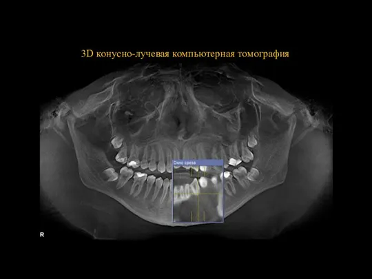 3D конусно-лучевая компьютерная томография