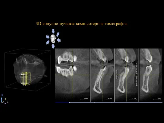 3D конусно-лучевая компьютерная томография