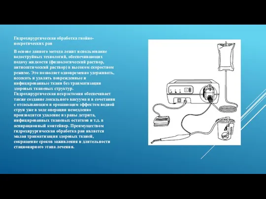 Гидрохирургическая обработка гнойно-некротических ран В основе данного метода лежит использование водоструйных технологий,