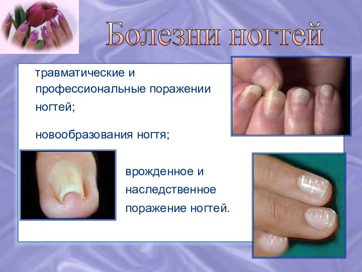 травматические и профессиональные поражении ногтей; новообразования ногтя; врожденное и наследственное поражение ногтей. Болезни ногтей