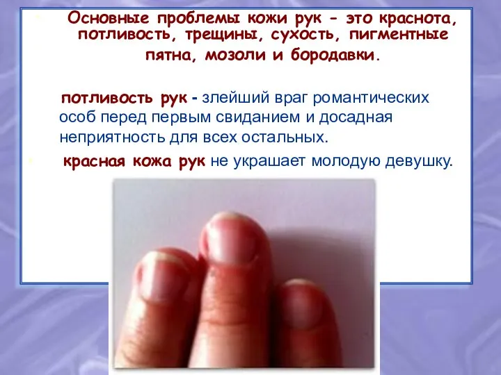 Основные проблемы кожи рук - это краснота, потливость, трещины, сухость, пигментные пятна,