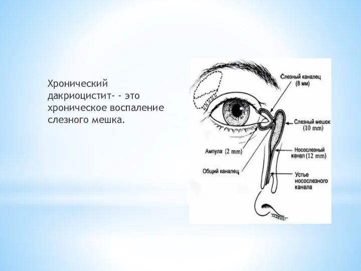 Хронический дакриоцистит- - это хроническое воспаление слезного мешка.