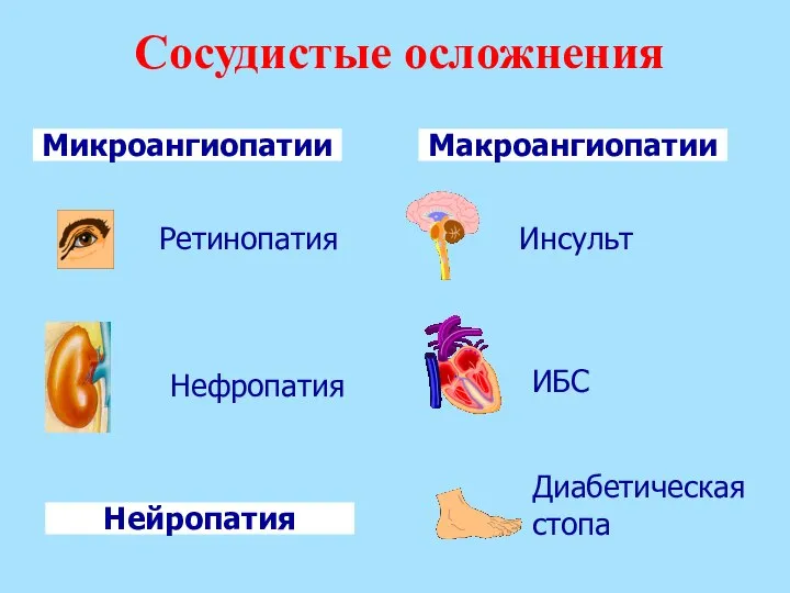 Сосудистые осложнения Микроангиопатии Макроангиопатии Инсульт ИБС Диабетическая стопа Ретинопатия Нефропатия Нейропатия