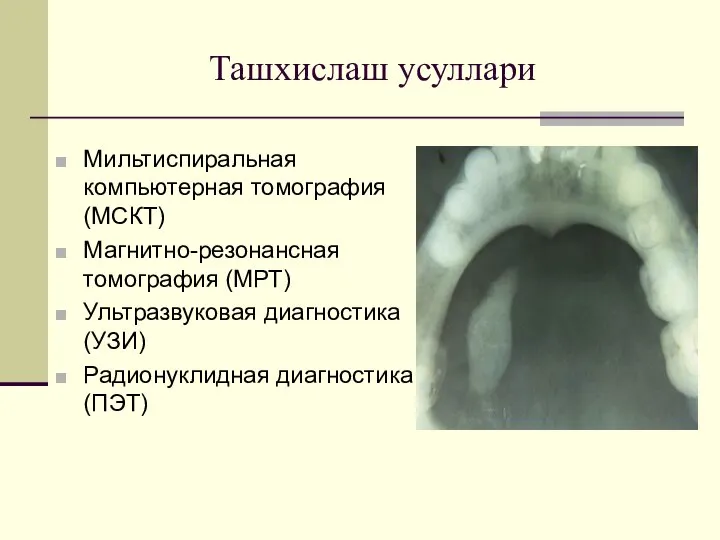 Ташхислаш усуллари Мильтиспиральная компьютерная томография (МСКТ) Магнитно-резонансная томография (МРТ) Ультразвуковая диагностика (УЗИ) Радионуклидная диагностика (ПЭТ)