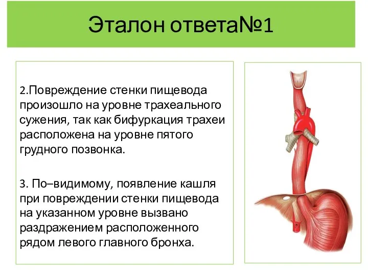 Эталон ответа№1 2.Повреждение стенки пищевода произошло на уровне трахеального сужения, так как