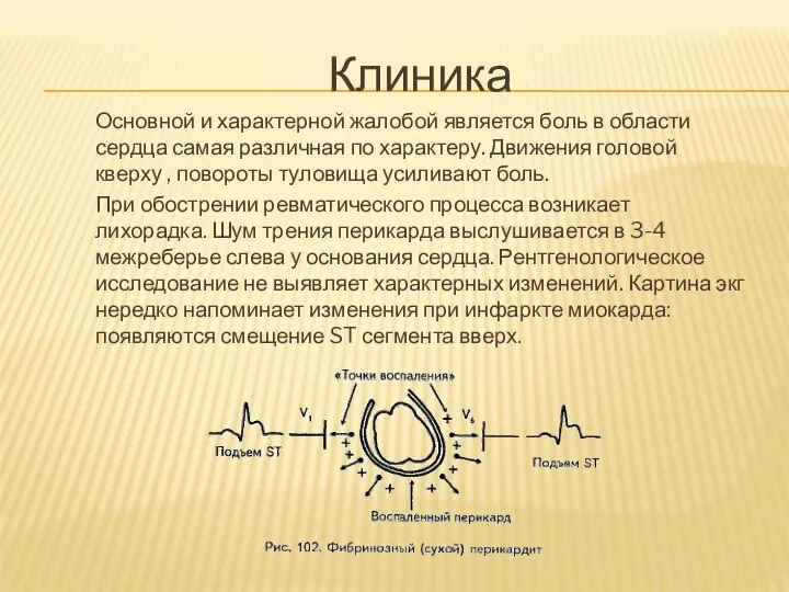 Клиника Основной и характерной жалобой является боль в области сердца самая различная