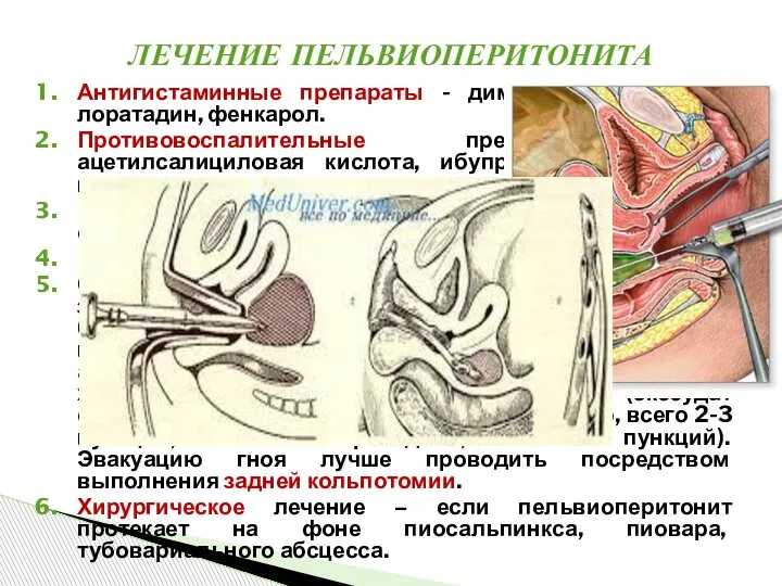 Антигистаминные препараты - димедрол, супрастин, лоратадин, фенкарол. Противовоспалительные препараты - ацетилсалициловая кислота,