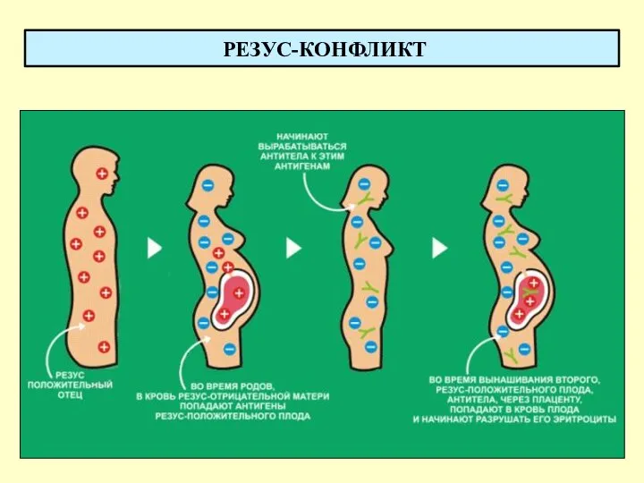 РЕЗУС-КОНФЛИКТ