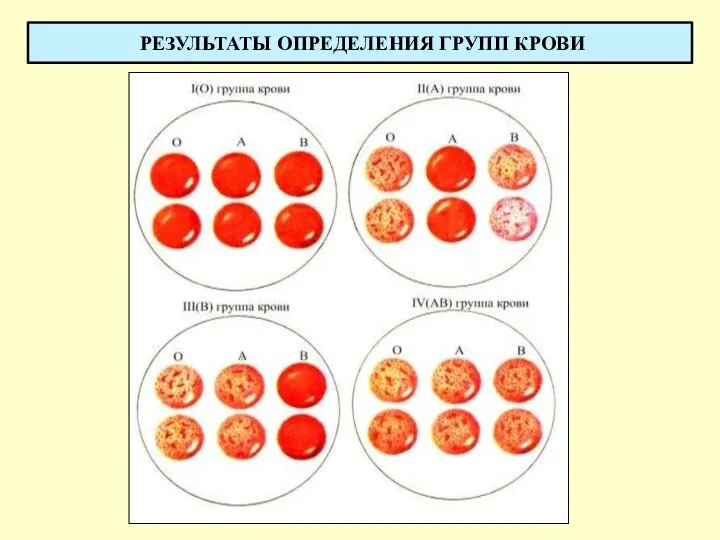 РЕЗУЛЬТАТЫ ОПРЕДЕЛЕНИЯ ГРУПП КРОВИ