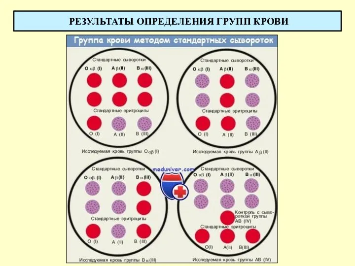 РЕЗУЛЬТАТЫ ОПРЕДЕЛЕНИЯ ГРУПП КРОВИ