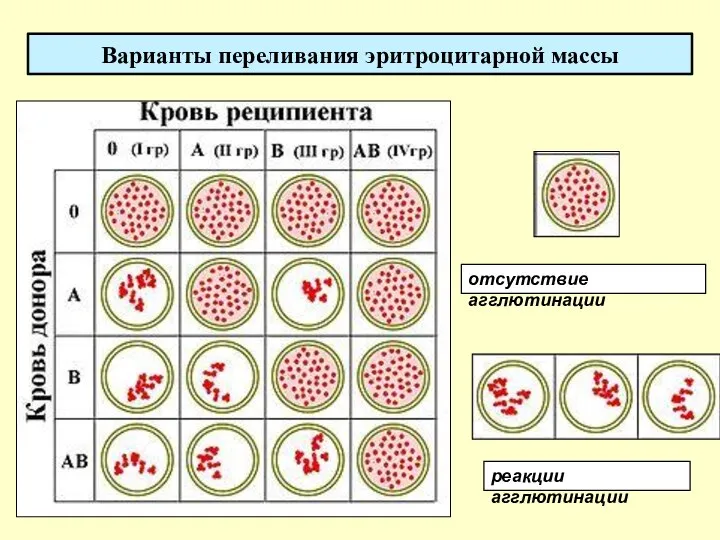 Варианты переливания эритроцитарной массы реакции агглютинации отсутствие агглютинации