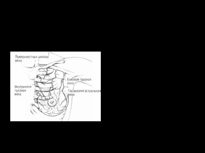 Венозный отток Внутригрудные и шейные вены Межреберные вены Подмышечная вена