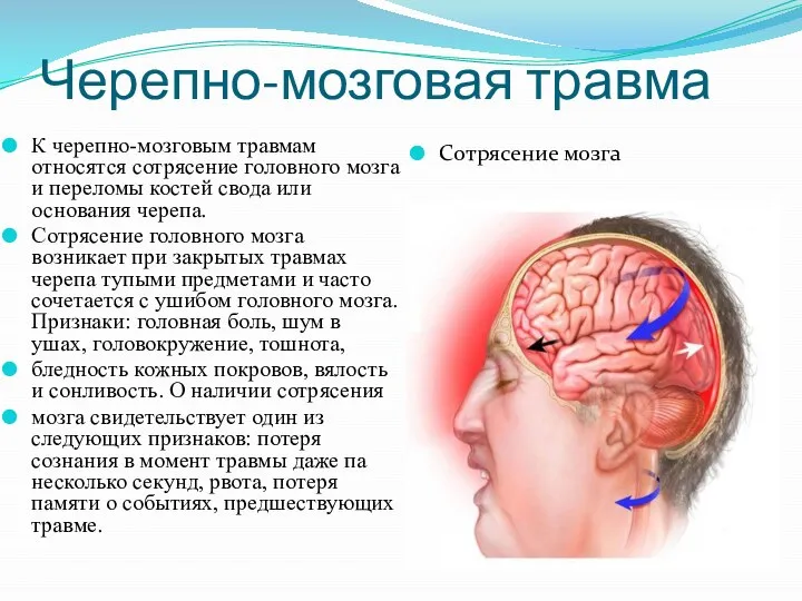 Черепно-мозговая травма К черепно-мозговым травмам относятся сотрясение головного мозга и переломы костей