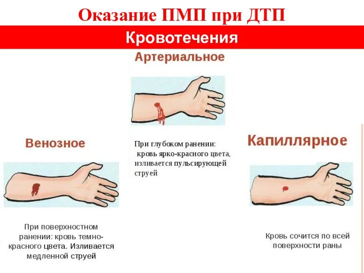 Оказание ПМП при ДТП Кровотечения