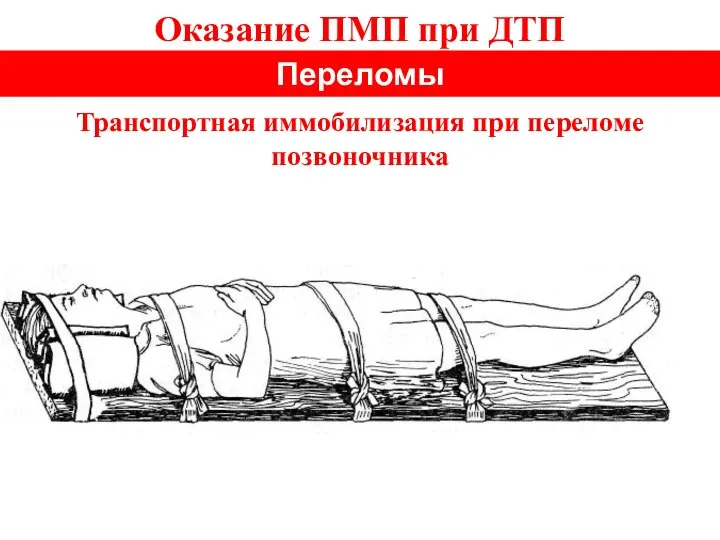 Оказание ПМП при ДТП Переломы Транспортная иммобилизация при переломе позвоночника