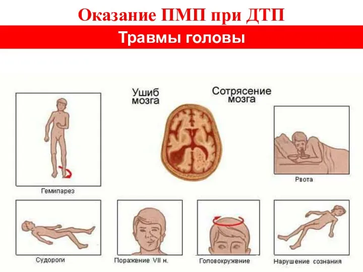 Оказание ПМП при ДТП Травмы головы