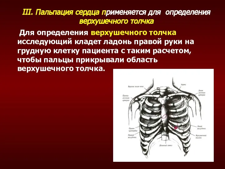 III. Пальпация сердца применяется для определения верхушечного толчка Для определения верхушечного толчка