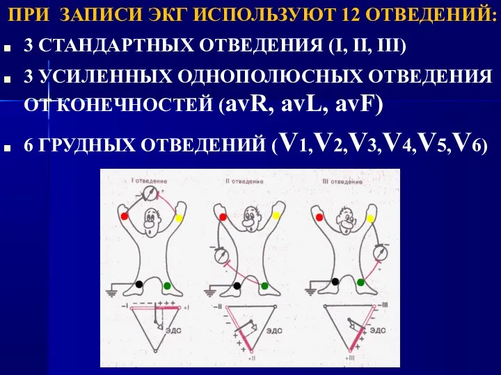 ПРИ ЗАПИСИ ЭКГ ИСПОЛЬЗУЮТ 12 ОТВЕДЕНИЙ: 3 СТАНДАРТНЫХ ОТВЕДЕНИЯ (I, II, III)