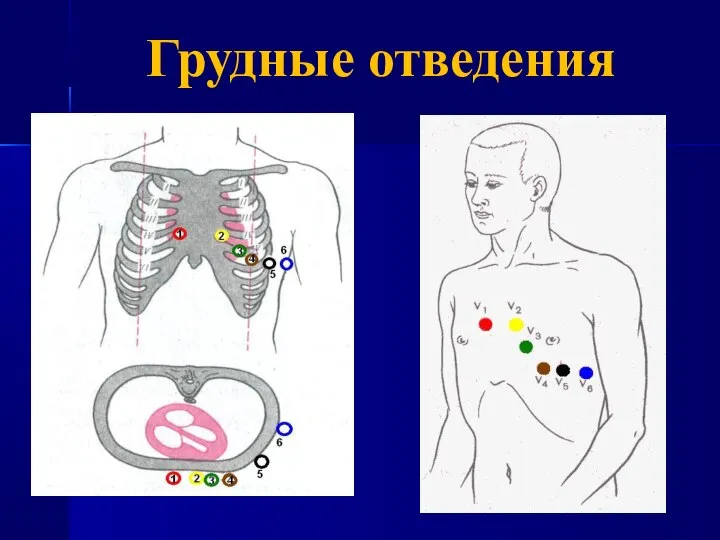 Грудные отведения