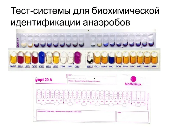 Тест-системы для биохимической идентификации анаэробов