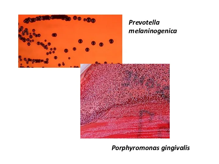 Prevotella melaninogenica Porphyromonas gingivalis