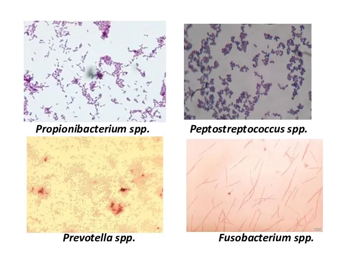Propionibacterium spp. Peptostreptococcus spp. Prevotella spp. Fusobacterium spp.