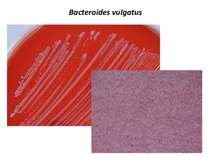 Bacteroides vulgatus