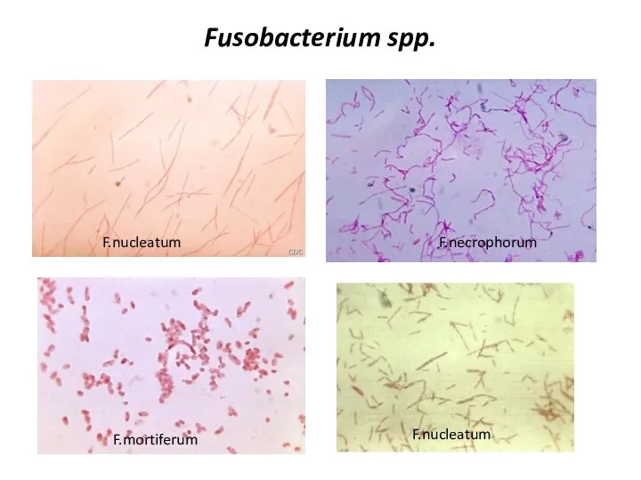 Fusobacterium spp. F.nucleatum F.nucleatum F.necrophorum F.mortiferum