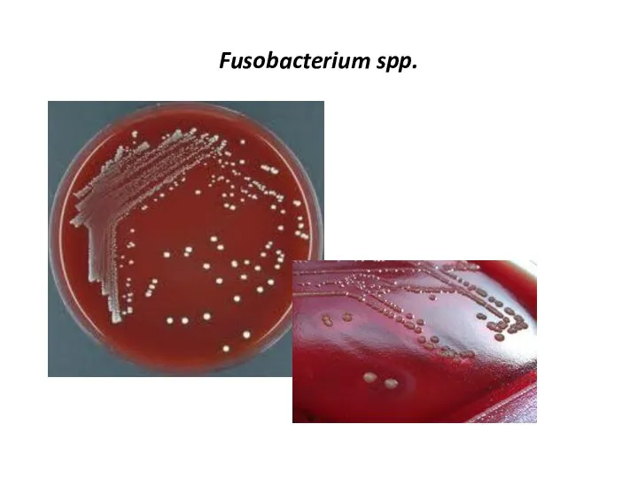 Fusobacterium spp.