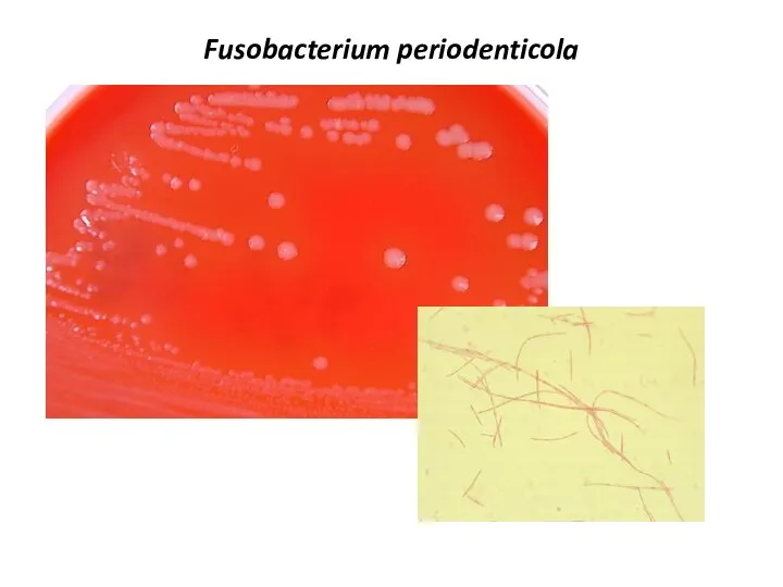 Fusobacterium periodenticola