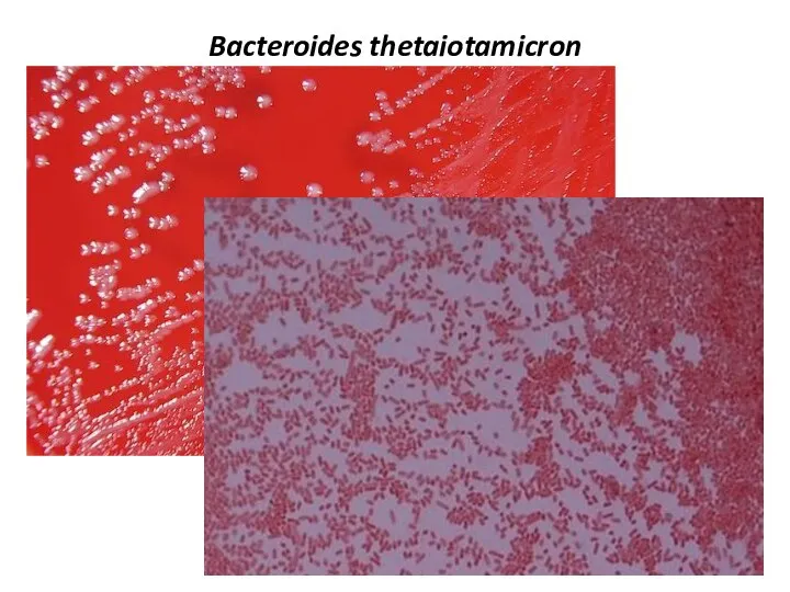 Bacteroides thetaiotamicron