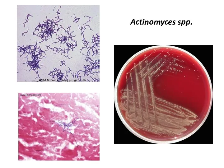 Actinomyces spp.