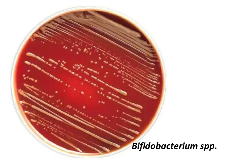 Bifidobacterium Bifidobacterium spp.