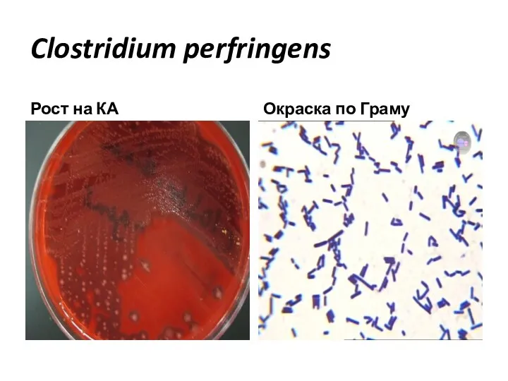 Clostridium perfringens Рост на КА Окраска по Граму